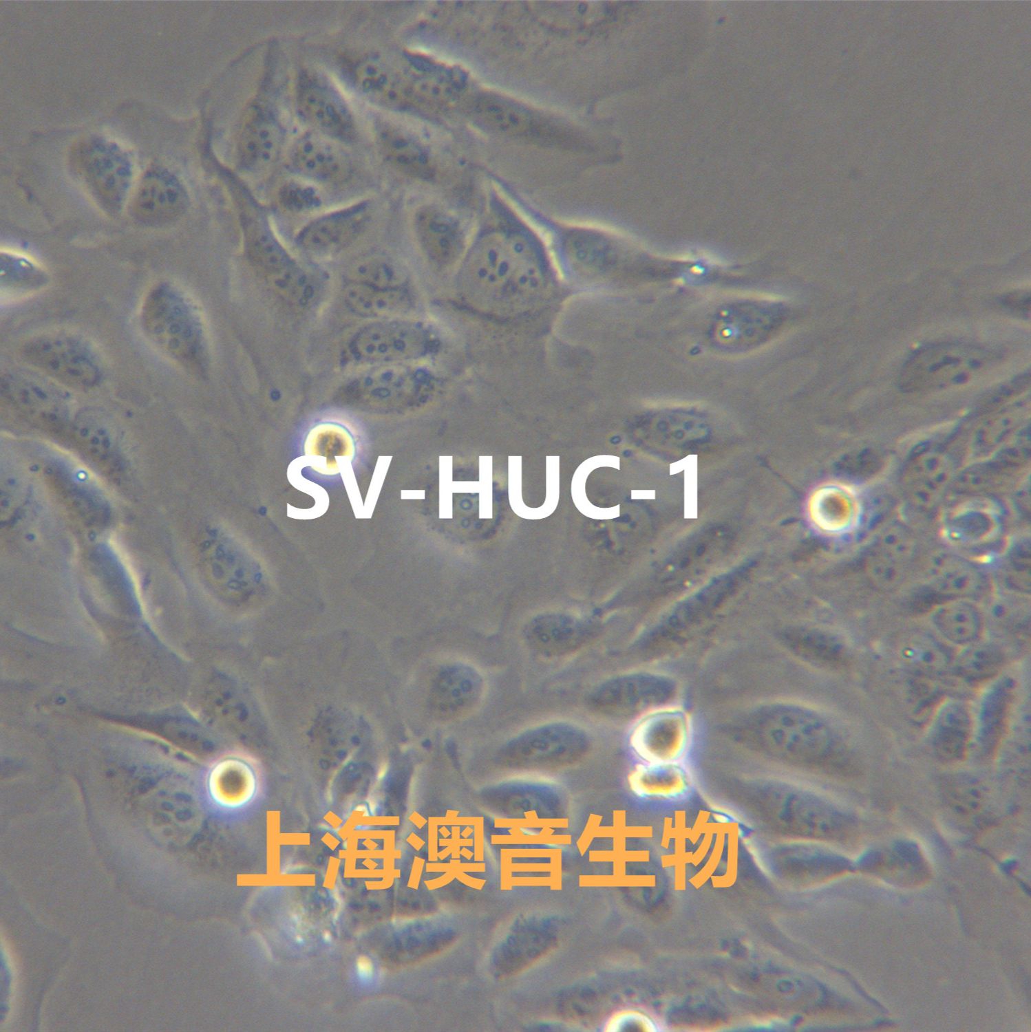 SV-HUC-1[HUC-1; SV-HUC; SVHUC]输尿管上皮细胞