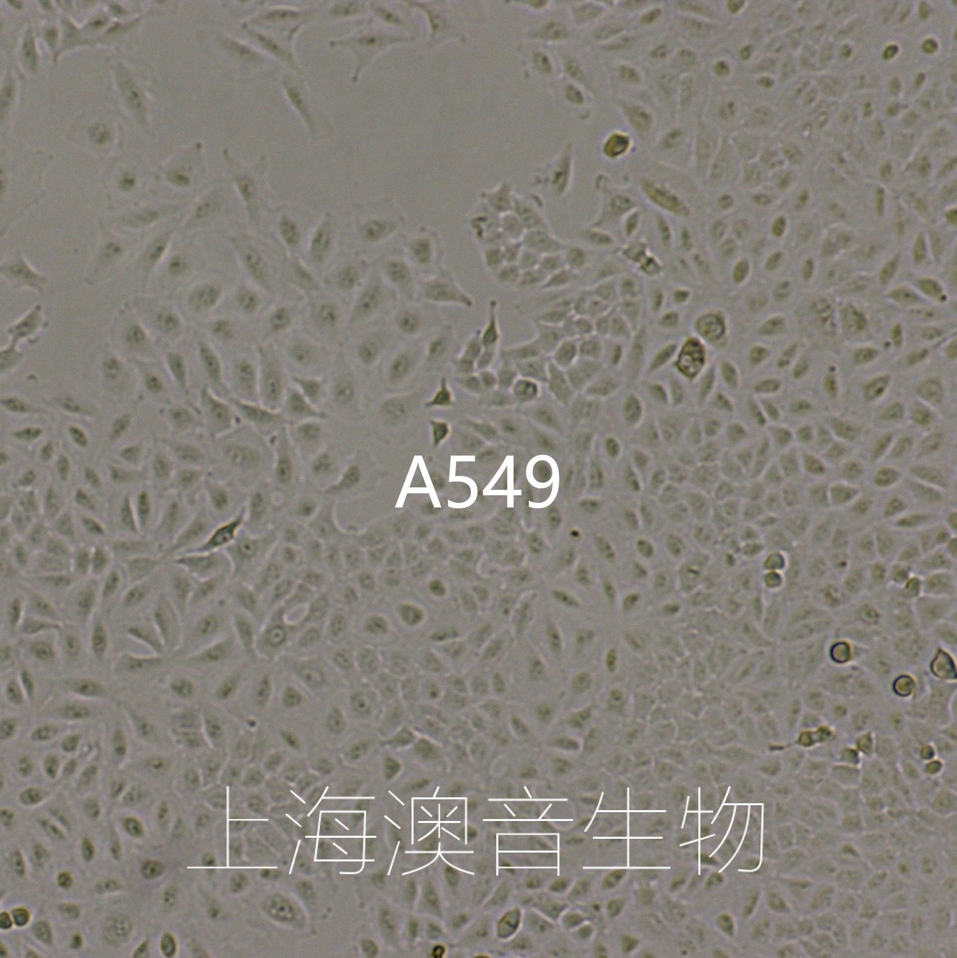 A549[A-549,A 549; A549; NCI-A549; A549/ATCC]非小细胞肺癌细胞