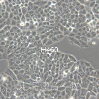 NCI-H460 [NCI.H460; H460; H-460; NCIH460; NCI-HUT-460; NCI-460]大细胞肺癌细胞
