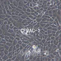CFPAC-1[	CFPac-1; CF PAC-1; CF-PAC1; CF-Pac1; CF Pac1; CFPAC1; CFPAC]胰腺癌细胞