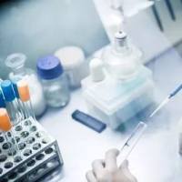 兔TATA框结合蛋白相关因子13(TAF13)ELISA试剂盒