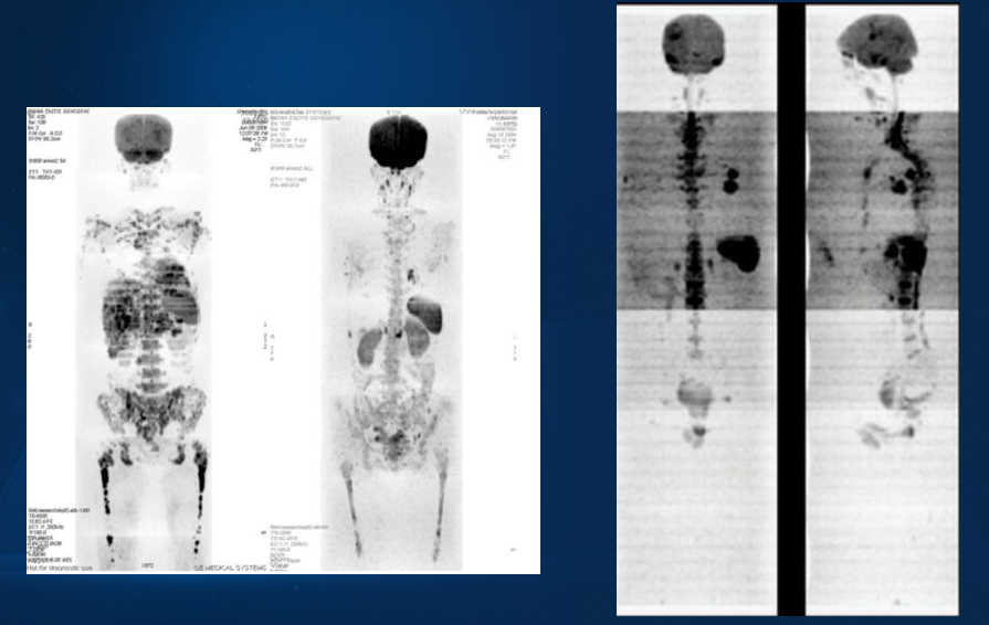 骨科排行_重点梳理!2023年骨科医械龙头股全名单出炉了(10月29日)