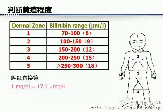 黄疸 新生儿生理性黄疸一般从 48 小时以后逐渐出现