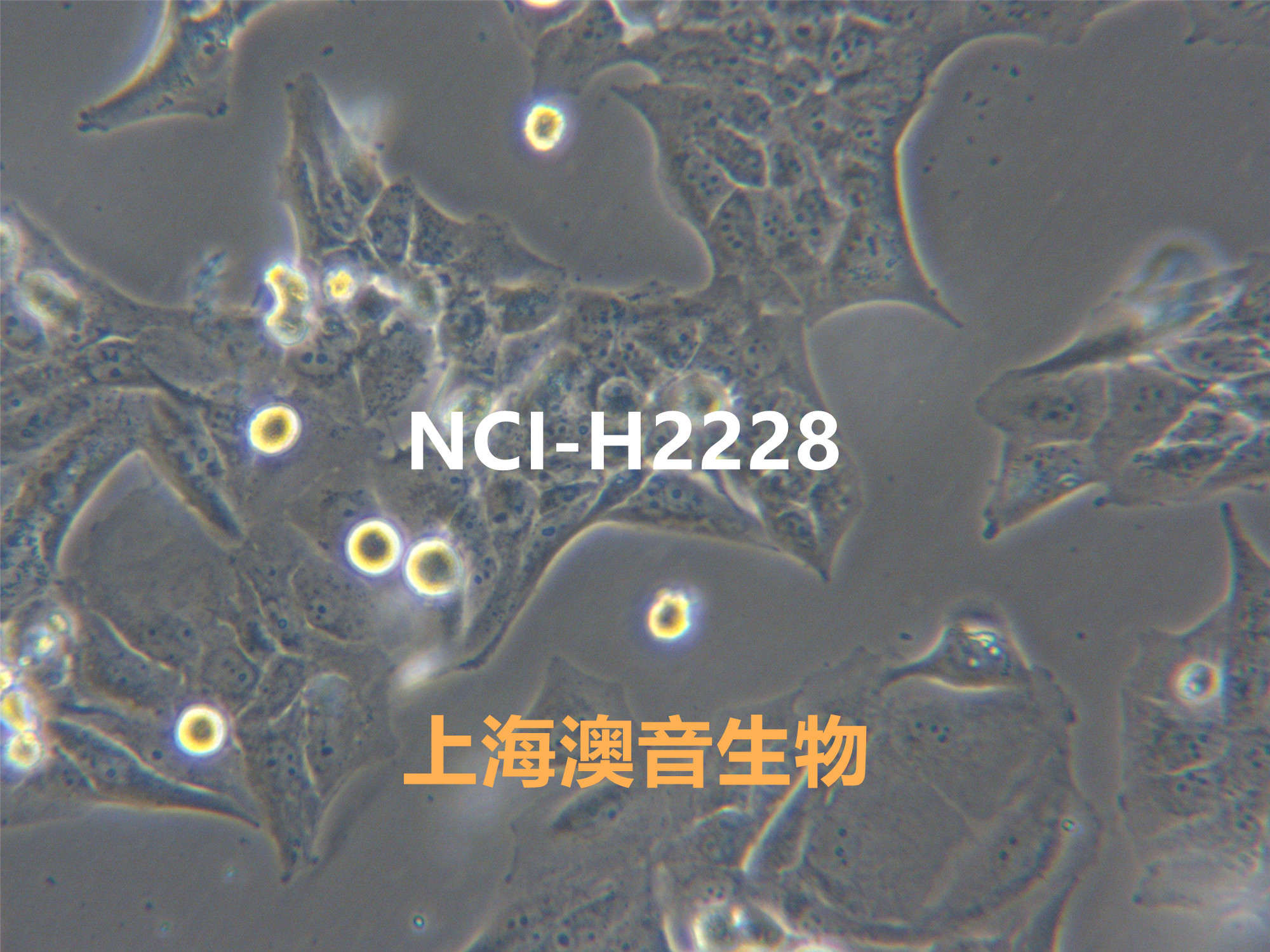 NCI-H2228[H2228; H-2228; NCIH2