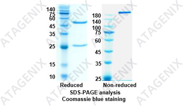 Anti SARS-CoV-2(2019-nCoV) RBD