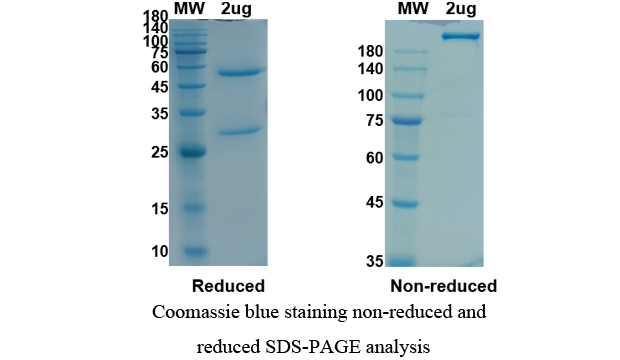 Anti SARS-CoV-2(2019-nCoV) RBD