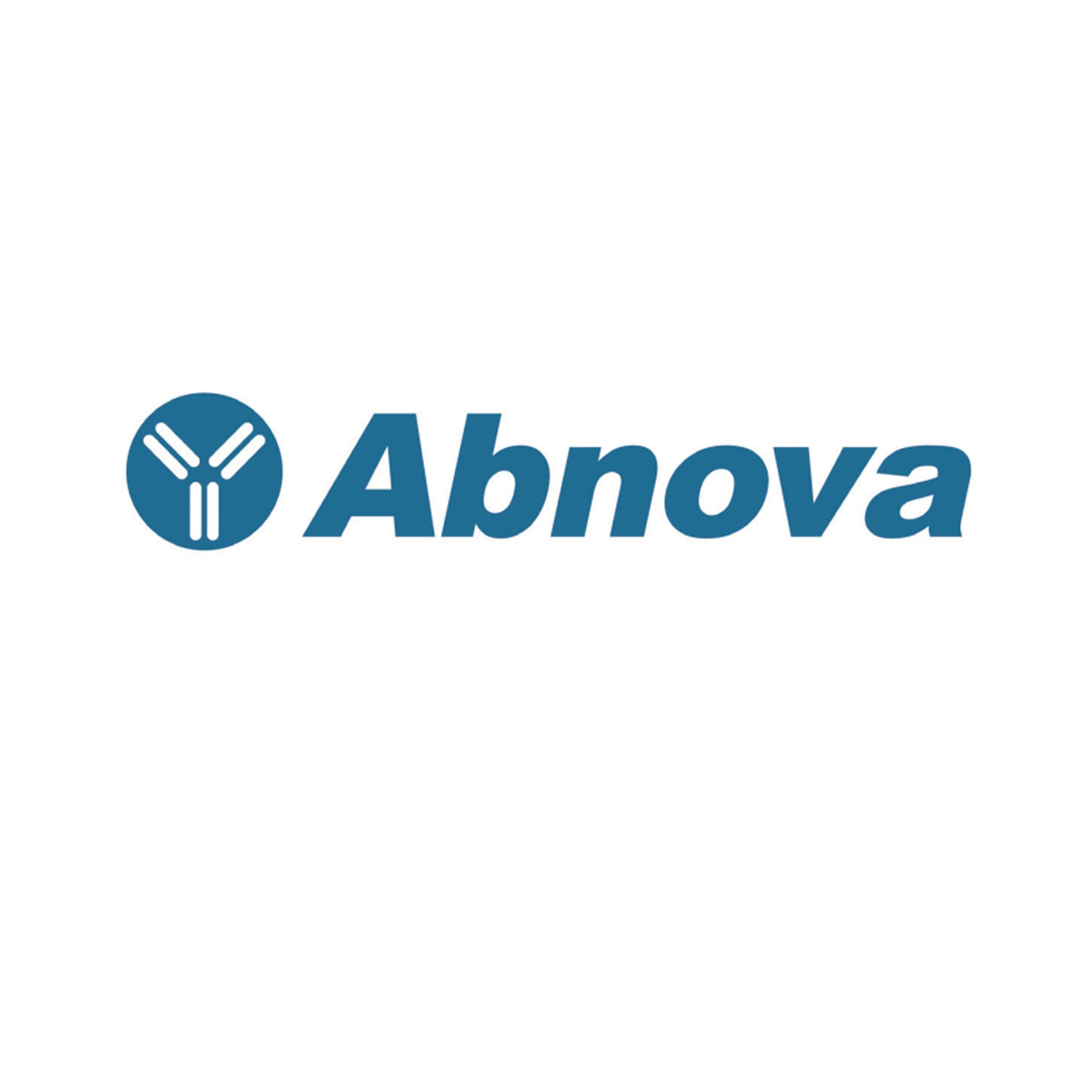 Abnova抗体、ELISA试剂盒、原位杂交荧光探针、无表达蛋白定量等等产品简介