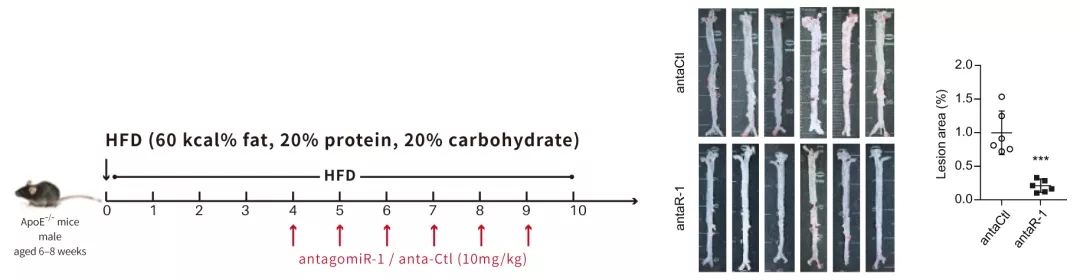 动物用miRNA antagomir案例应用策略解析(20210630)丨含动物造模、实验处理、给药方式、给药剂量……