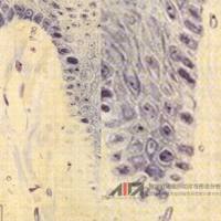 游离龈切片-无炎症结缔组