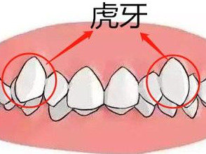 王俊凯整牙记:关于虎牙的救赎之路