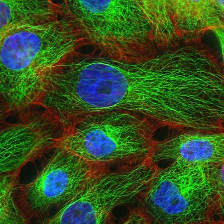 人肝癌组织源细胞