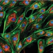 甲状腺乳头状癌细胞K1 、K1细胞 