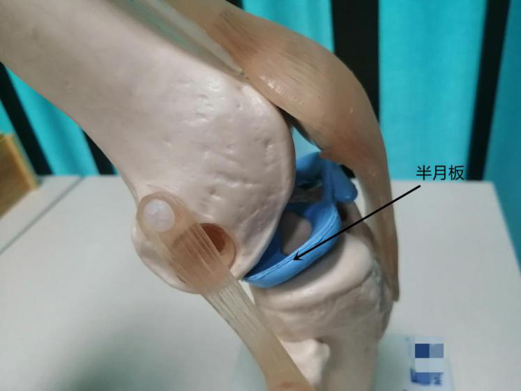 武汉首颐堂:膝关节半月板手术,术后跟踪对临床的启示