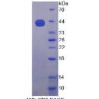胰岛素样生长因子2-mRNA结合蛋白3(IGF2BP3)重组蛋白
