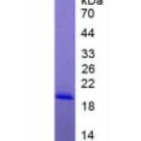 白介素1家族成员9(IL1F9)重组蛋白