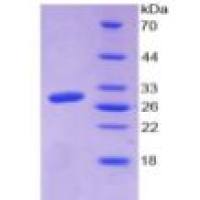 结缔组织生长因子(CTGF)重组蛋白