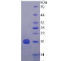 泛素交叉反应蛋白(UCRP)重组蛋白