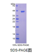 趋化因子C-C-基元配体3样蛋白1(CCL3L1)重组蛋白