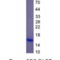 脑源性神经营养因子(BDNF)重组蛋白