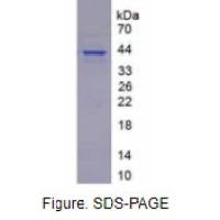 FMS样酪氨酸激酶3配体(Flt3L)重组蛋白（人）