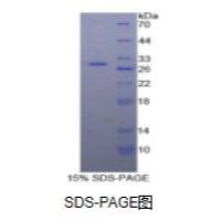 趋化因子C-X3-C-基元配体1(CX3CL1)重组蛋白