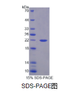 FMS样酪氨酸激酶3配体(Flt3L)重组蛋白(小鼠)