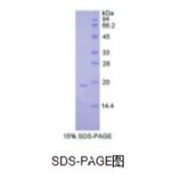 粒细胞集落刺激因子(GCSF)重组蛋白(人）