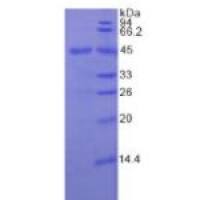 粒细胞巨噬细胞集落刺激因子(GM-CSF)重组蛋白（人）