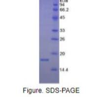 干扰素γ(IFNg)重组蛋白（鸡）