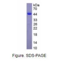 白介素12B(IL12B)重组蛋白