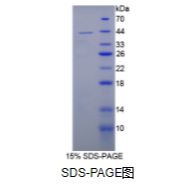 白介素12B(IL12B)重组蛋白（大鼠）