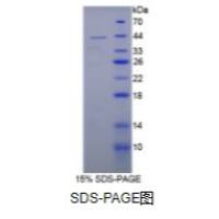 白介素12B(IL12B)重组蛋白（大鼠）