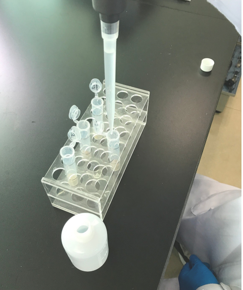 酪氨酸解氨酶(TAL)样本处理及要求