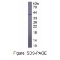 白介素12B(IL12B)重组蛋白(鸡)