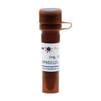 SP600125 (JNK抑制剂)