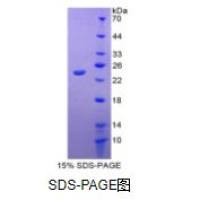 白介素18(IL18)重组蛋白（兔）