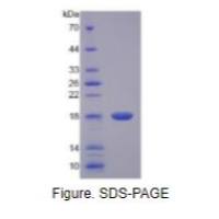 白介素17(IL17)重组蛋白（大鼠）