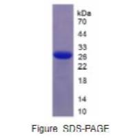 白介素6(IL6)重组蛋白(恒河猴)