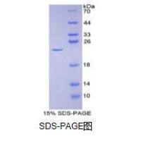 白介素2(IL2)重组蛋白（小鼠）