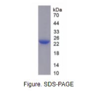 白介素6(IL6)重组蛋白（大鼠）
