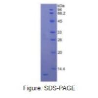 白介素8(IL8)重组蛋白