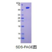 白介素6(IL6)重组蛋白（兔）