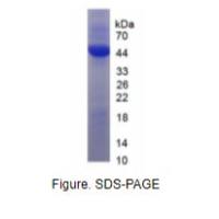 巨噬细胞集落刺激因子(MCSF)重组蛋白(大鼠)