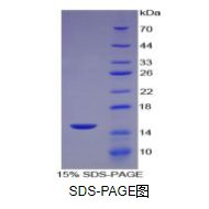 单核细胞趋化蛋白2(MCP2)重组蛋白