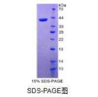 巨噬细胞来源趋化因子(MDC)重组蛋白