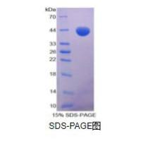 单核细胞趋化蛋白1(MCP1)重组蛋白（猪）