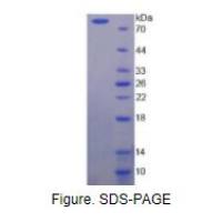 巨噬细胞集落刺激因子(MCSF)重组蛋白