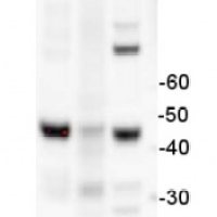 ACT | Actin (polyclonal)