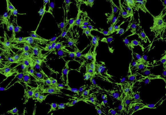 JeKo-1 人套细胞淋巴瘤细胞