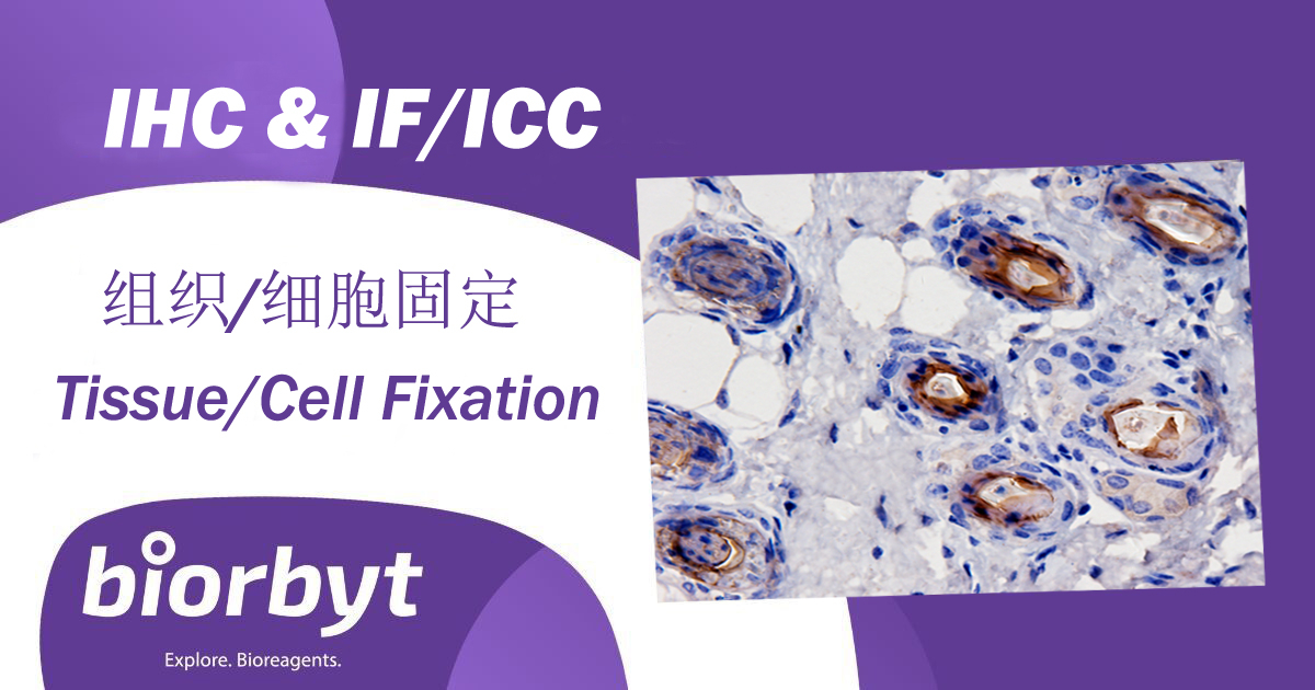 【Biorbyt 技术】免疫组化/荧光如何选择固定剂？